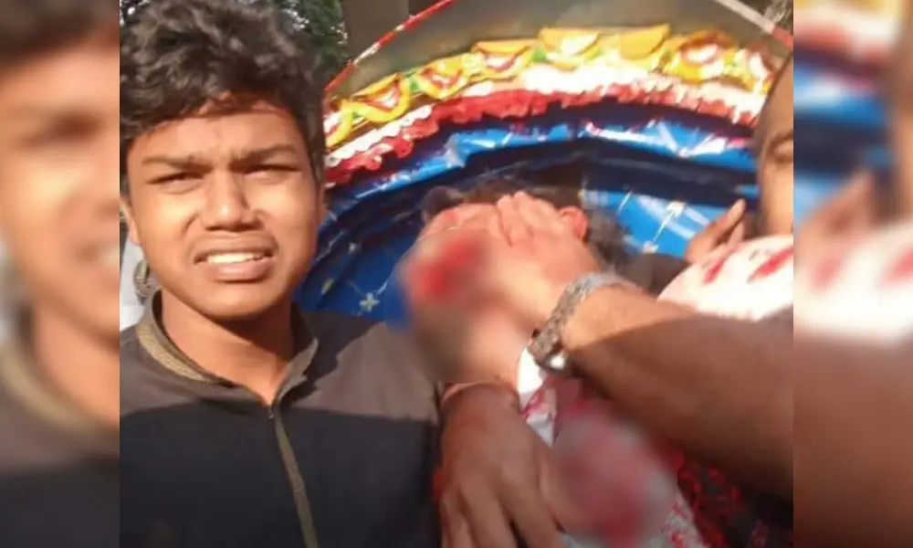 গুলিবিদ্ধ ওসমান হাদি এখন কোমায় আছেন : চিকিৎসক hadi guli iddho