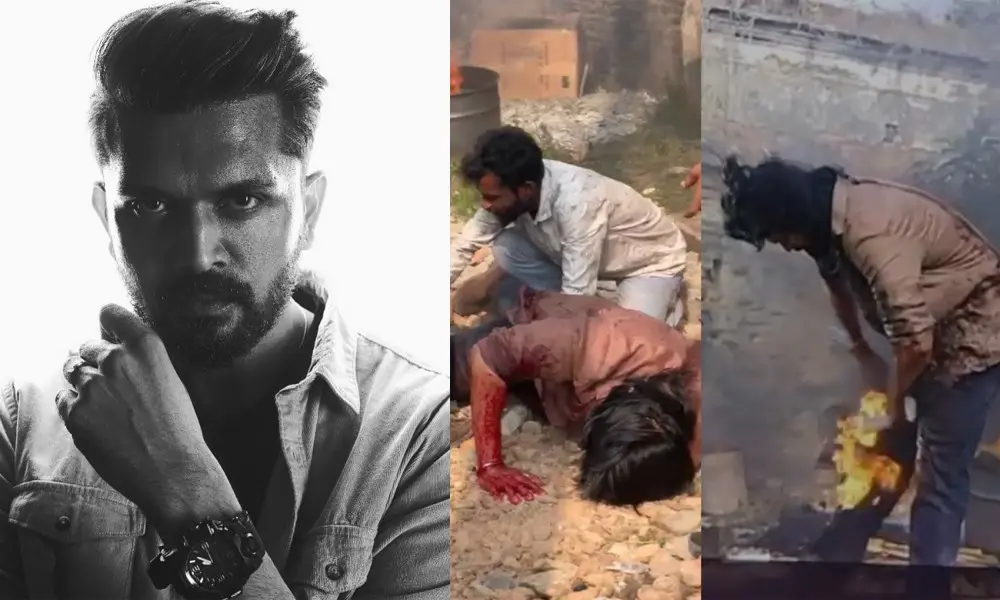 শুটিং সেটে অগ্নিদগ্ধ চিত্রনায়ক আরিফিন শুভ shuvo